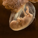 Jewish Rabbi Claims Life Beginning at Conception is Religion; Not Science